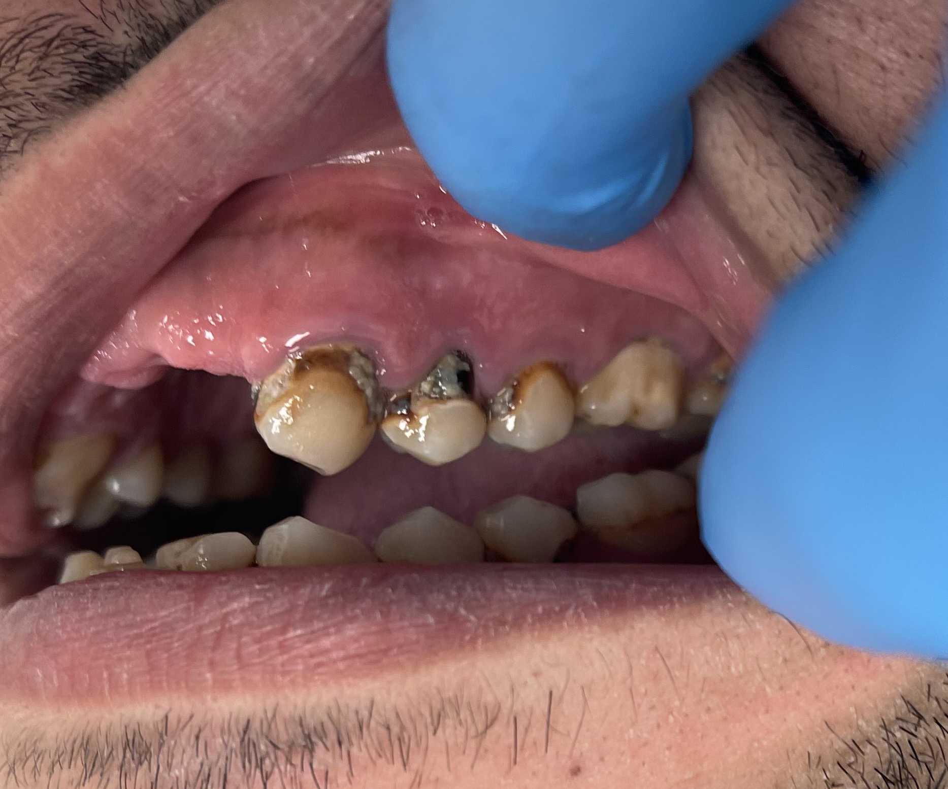 Bedford's Medicaid & HIP Dentist